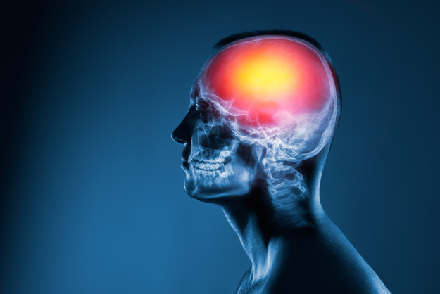 Acquired Brain Injury